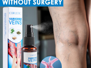 30ml Varicose Vein Spray Multi-Purpose Knee And Leg Care Spray Promote Blood Circulation